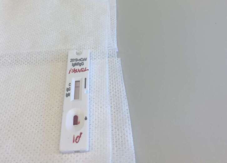 Imagen de archivo de un test de autodiagnóstico / TA